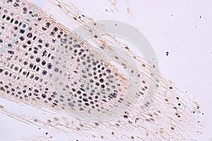 Mitosis cell in the Root tip of Onion under a microscope.