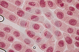 Mitosis cell in the Root tip of Onion under a microscope.