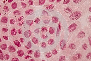 Mitosis cell in the Root tip of Onion under a microscope.