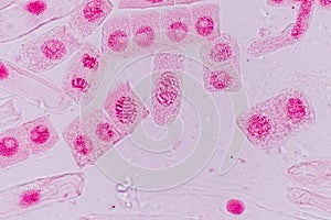 Mitosis cell in the Root tip of Onion under a microscope.