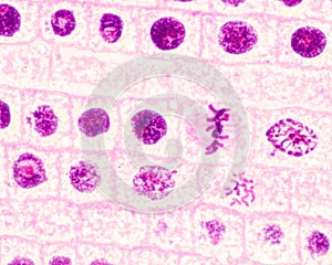 Mitosis. Root meristem photo