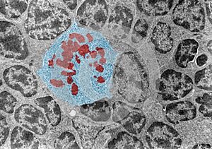 Mitosis. TEM photo