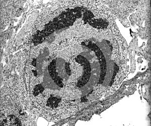 Mitosis. TEM micrograph photo
