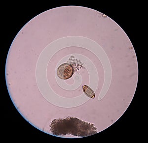 Mix egg parasite human