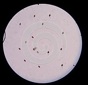 Mix egg parasite human