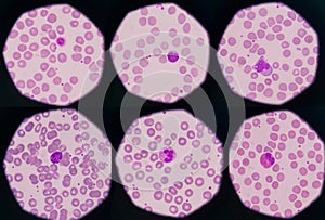 Mix White blood cells.