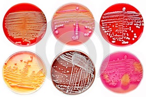 Mixed of bacteria colonies in petri dish