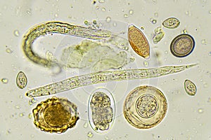 Mixed of helminthes in stool