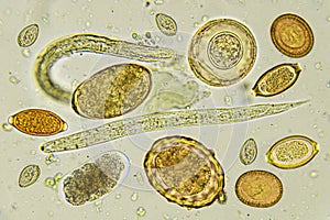 Mixed of helminths or parasitic worm in stool