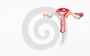 Mock female reproductive system on a white background. The concept of sexually transmitted infections, bacterial