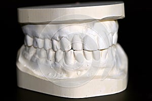 Model of adult teeth making from plaster