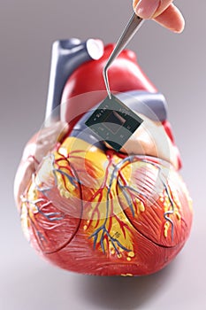 Model of heart with cardiac pacemaker in form of chip