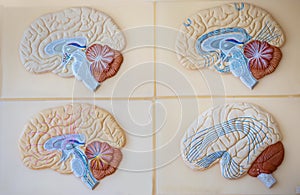 Model of the human brain for teaching in the medical class