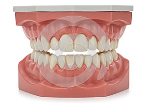 Model human jaw with teeth