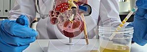 Model of human kidney and ureter on table of urologist doctor with urinalysis test closeup