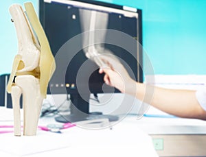 Model Human knee and leg with stethoscope on white table for medical education and x-ray knee on LCD mornitor in the clinic.