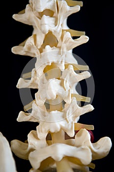 A section of a human spine showing the vertibrae and spinal cord.