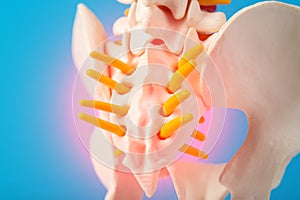 Model of the human spine, section of the inflamed coccyx with nerves on a blue background. Pinched nerve due to problems