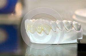 Model of human teeth