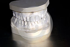 Model of human teeth made from plaster