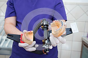 model of the jaw in the articulator in the hand of a young doctor. The dentist shows the unfolded articulator