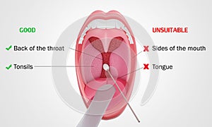 A model of making a throat swab using cotton buds wrapped around a wooden stick. Poke and spin on the Back of the throat or