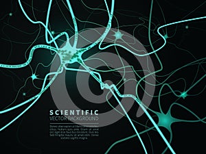 Model of neural system