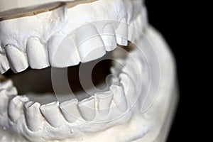 Model of plaster cast from above and lower teeth of human