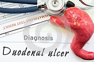 Model of stomach, blood test and stethoscope lying next to written title on paper diagnosis Duodenal Ulcer. Concept photo of cause