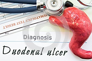 Model of stomach, blood test and stethoscope lying next to written title on paper diagnosis Duodenal Ulcer. Concept photo of cause photo