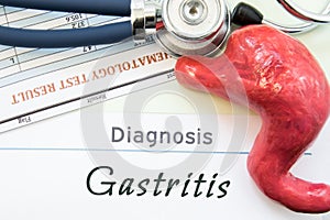 Model of stomach, blood test and stethoscope lying next to written title on paper diagnosis Gastritis. Concept photo of causes, di