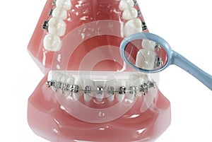 Model of Teeth with Braces and mirror