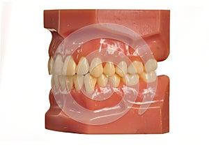 Model teeth and gums on white