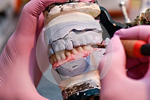 Modeling the installation of a denture with wax close up.