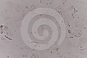 Moderate epithelial cells in urine specimen