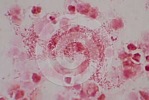 Moderate gram  nagative bacilli with white blood cells