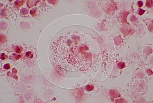 Moderate gram  nagative bacilli with white blood cells