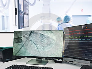 Modern Cath Lab showing LCD monitor with the doctor, nurse, and patient in the hospital, patient during treatment in Cath Lab