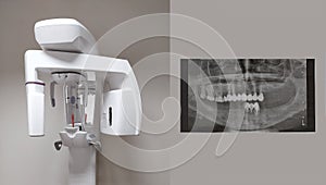 Modern dental digital 3D tomograph