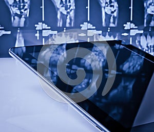 Modern digital tablet on x-ray images background