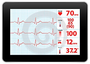 Modern Electrocardiogram Monitor Device Display photo