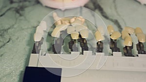 Modern examples of dental implants