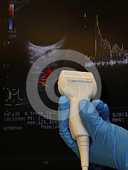 Modern linear ultrasound diagnostic probe held in doctor left hand in blue glove with doppler ocular ultrasound scan