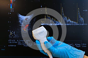 Modern linear ultrasound diagnostic probe held in doctor left hand in blue glove with doppler ocular ultrasound scan
