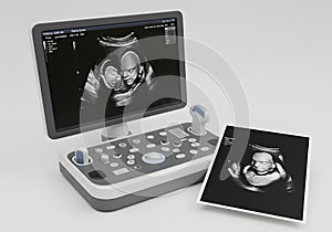 Modern ultrasound machine displaying fetal image photo