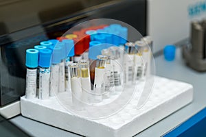 Modern medicine testing analises. Blood samples test tubes in medical laboratory.