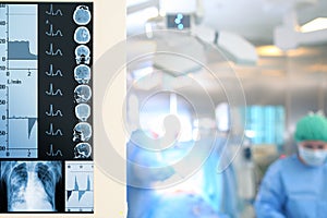 Modern monitoring of the patient during surgery