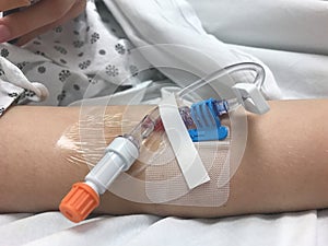 Modern Peripheral venous catheter for intravenous infusion on female arm in hospital