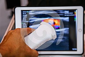 Modern portable ultrasound machine in clinic laboratory of sonography diagnostics