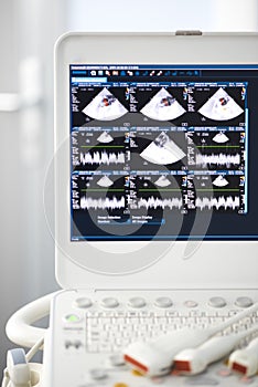 Modern ultrasound machine